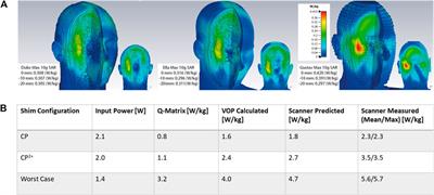 A Nested Eight-Channel Transmit Array With Open-Face Concept for Human Brain Imaging at 7 Tesla